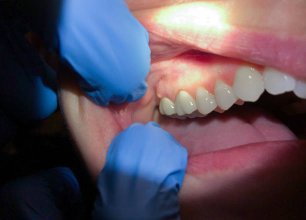 Best Weekend Emergency Dentist in Laurel Hill, VA