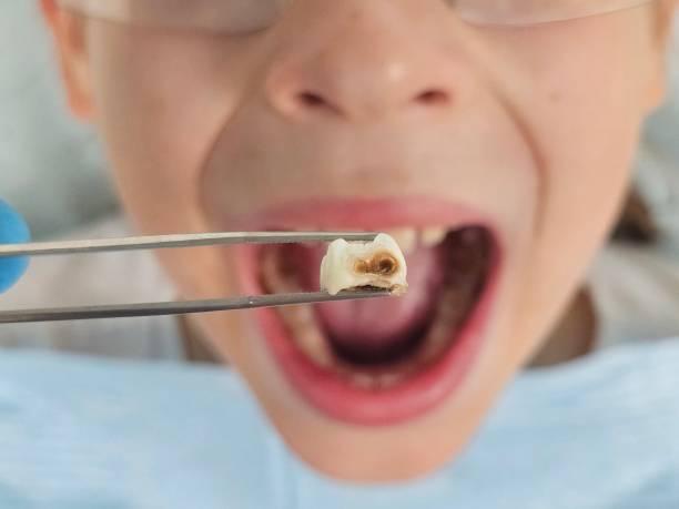 Best Emergency Treatment for Toothache in Laurel Hill, VA
