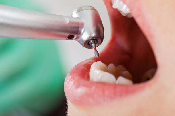 Best Walk-In Emergency Dentist in Laurel Hill, VA